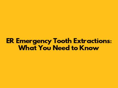 ER Emergency Tooth Extractions: What You Need to Know
